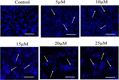 Cucurbitacin-B instigates intrinsic apoptosis and modulates Notch signaling in androgen-dependent prostate cancer LNCaP cells